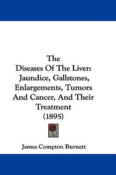 Paperback The Diseases Of The Liver: Jaundice, Gallstones, Enlargements, Tumors And Cancer, And Their Treatment (1895) Book