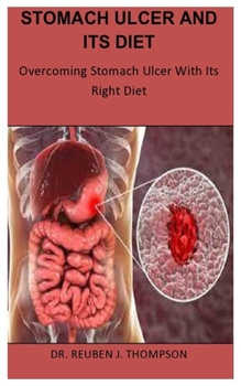 Paperback Stomach Ulcer and Its Diet: Overcoming Stomach Ulcer With Its Right Diet Book