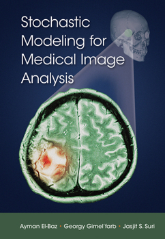 Paperback Stochastic Modeling for Medical Image Analysis Book