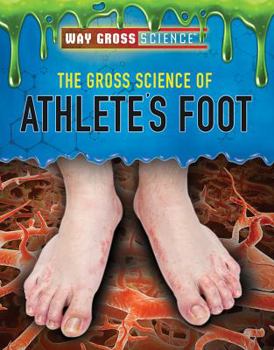 Library Binding The Gross Science of Athlete's Foot Book