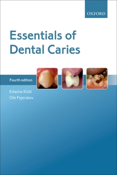 Paperback Essentials of Dental Caries 4e P Book