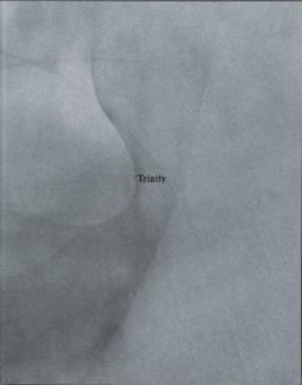 Hardcover Buck Ellison Living Trust /anglais Book