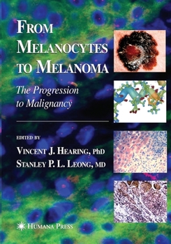 Paperback From Melanocytes to Melanoma: The Progression to Malignancy Book