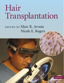 Hardcover Hair Transplantation Book