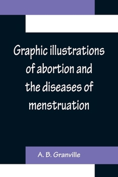 Graphic illustrations of abortion and the diseases of menstruation; Consisting of Twelve Plates from Drawings Engraved on Stone, and Coloured by Mr. J