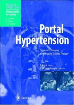 Portal Hypertension: Diagnostic Imaging and Imaging-Guided Therapy