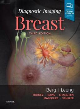 Hardcover Diagnostic Imaging: Breast Book