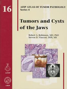 Hardcover Tumors and Cysts of the Jaws Book