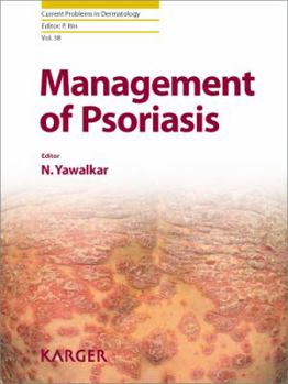 Hardcover Management of Psoriasis Book