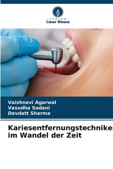 Paperback Kariesentfernungstechniken im Wandel der Zeit [German] Book