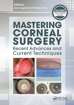 Paperback Mastering Corneal Surgery: Recent Advances and Current Techniques Book