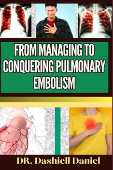 Paperback From Managing to Conquering Pulmonary Embolism: Expert Guide To Understanding the Causes, Recognizing Symptoms, Prevention and Embracing Effective Tre Book