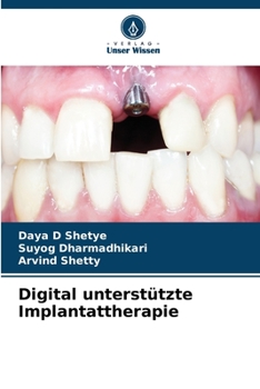 Paperback Digital unterstützte Implantattherapie [German] Book