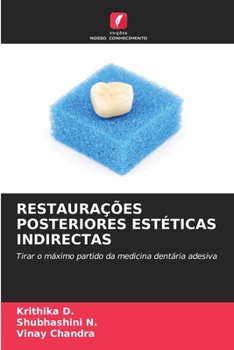 Paperback Restaurações Posteriores Estéticas Indirectas [Portuguese] Book