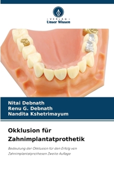 Okklusion für Zahnimplantatprothetik (German Edition)