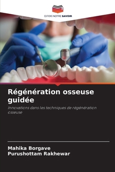 Régénération osseuse guidée (French Edition)