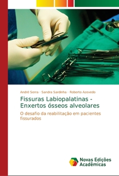 Paperback Fissuras Labiopalatinas - Enxertos ósseos alveolares [Portuguese] Book