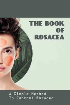 Paperback The Book Of Rosacea- A Simple Method To Control Rosacea: Rosacea Treatment For Face Book