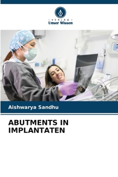 Paperback Abutments in Implantaten [German] Book