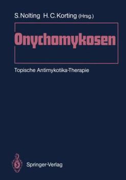 Paperback Onychomykosen: Topische Antimykotika-Therapie [German] Book