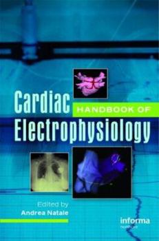 Hardcover Handbook of Cardiac Electrophysiology Book