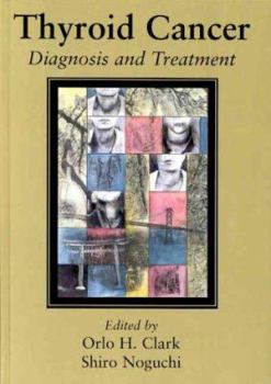Hardcover Thyroid Cancer: Diagnosis And Treatment Book