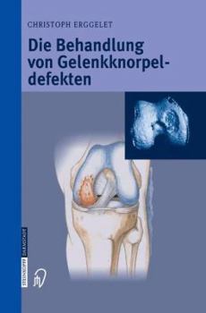 Paperback Die Behandlung Von Gelenkknorpeldefekten [German] Book