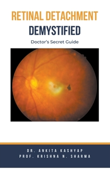 Paperback Retinal Detachment Demystified: Doctor's Secret Guide Book