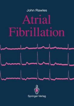 Paperback Atrial Fibrillation Book