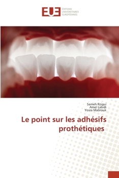 Le point sur les adhésifs prothétiques (French Edition)