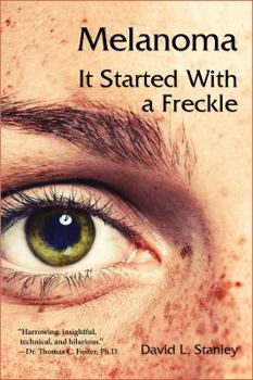 Paperback Melanoma: It Started With a Freckle Book