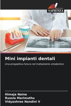 Paperback Mini impianti dentali [Italian] Book