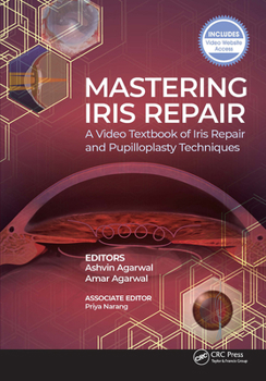 Paperback Mastering Iris Repair: A Video Textbook of Iris Repair and Pupilloplasty Techniques Book