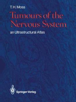 Paperback Tumours of the Nervous System: An Ultrastructural Atlas Book