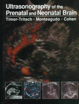 Hardcover Ultrasonography of the Prenatal and Neonatal Brain Book