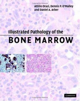 Hardcover Illustrated Pathology of the Bone Marrow Book