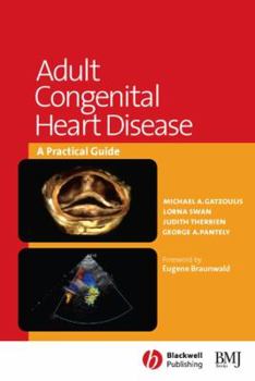 Paperback Adult Congenital Heart Disease: A Practical Guide Book