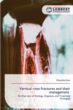 Paperback Vertical root fractures and their management Book