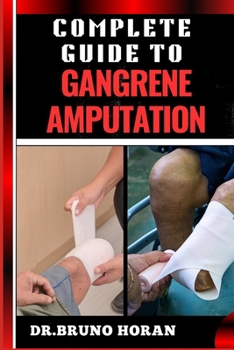 COMPLETE GUIDE TO GANGRENE AMPUTATION: Comprehensive Handbook To Diagnosis, Prevention, Treatment, And Recovery Strategies For Optimal Health Outcomes