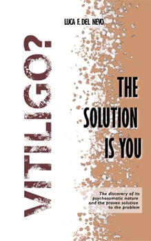 Paperback Vitiligo? The solution is you: The psychosomatic nature and a proven approach to healing Book