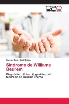 Paperback Síndrome de Williams Beurem [Spanish] Book