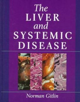 Hardcover The Liver and Systemic Disease Book