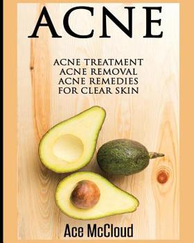 Paperback Acne: Acne Treatment: Acne Removal: Acne Remedies For Clear Skin Book