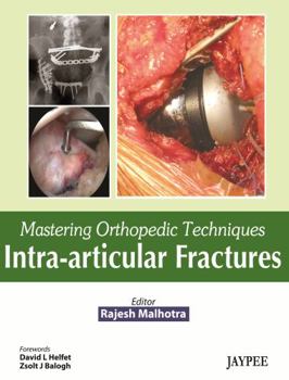 Mastering Orthopedic Techniques: Intra-Articular Fractures