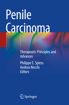 Paperback Penile Carcinoma: Therapeutic Principles and Advances Book
