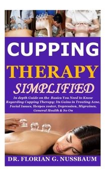 Paperback Cupping Therapy Simplified: In depth Guide on the Basics You Need to Know Regarding Cupping Therapy;Its Gains in Treating Acne, Facial Issues, Her Book
