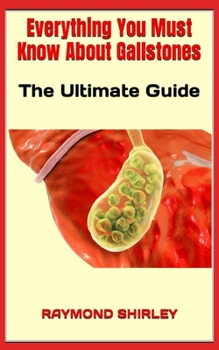 Paperback Everything You Must Know About Gallstones: The Ultimate Guide Book