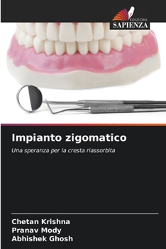 Paperback Impianto zigomatico [Italian] Book