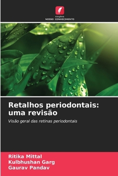 Retalhos periodontais: uma revisão (Portuguese Edition)
