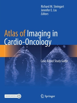 Paperback Atlas of Imaging in Cardio-Oncology: Case-Based Study Guide Book